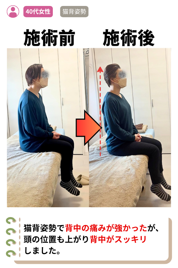 猫背姿勢で背中の痛みが強かったが、頭の位置も上がり背中がスッキリ
しました。