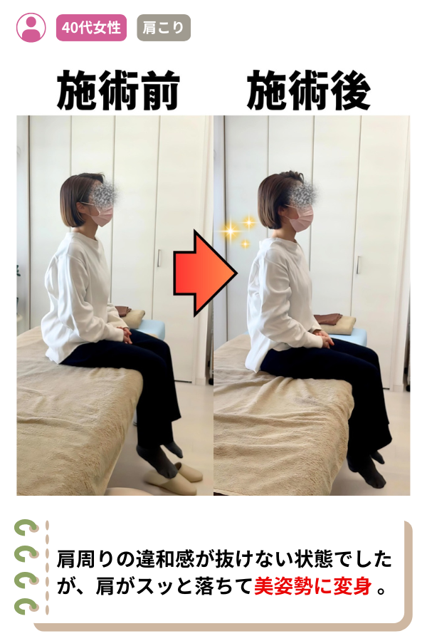 肩周りの違和感が抜けない状態でしたが、肩がスッと落ちて美姿勢に変身