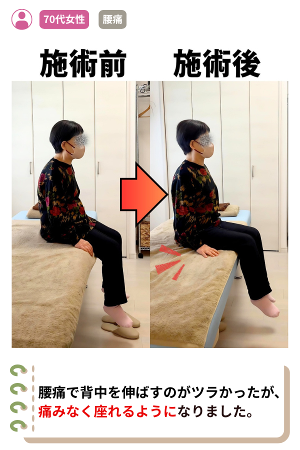 腰痛で背中を伸ばすのがツラかったが、痛みなく座れるようになりました。