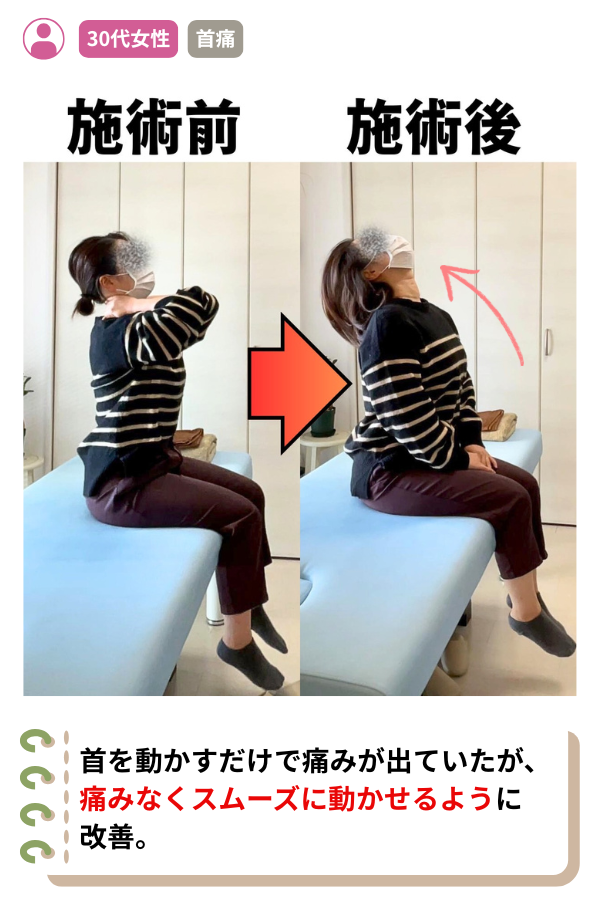 首を動かすだけで痛みが出ていたが、痛みなくスムーズに動かせるように
改善。